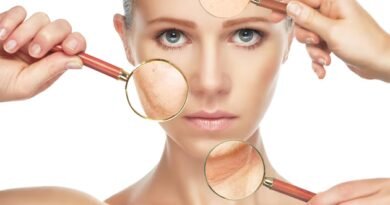 Hiperpigmentasyon Nedir? Nedenleri, Belirtileri ve Tedavi Yöntemleri nelerdir?