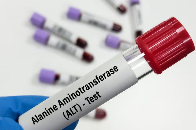 ALT Nedir? Yüksek ve Düşük Değerlerinin Anlamı