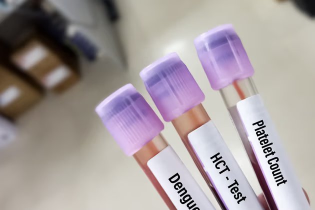 Dengue Ateşi Nedir? Belirtileri ve Korunma Yöntemleri
