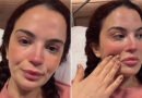 Aslı Bekiroğlu Tekrar Ameliyat Oluyor: "Son İnşallah!"