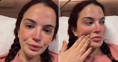 Aslı Bekiroğlu Tekrar Ameliyat Oluyor: "Son İnşallah!"
