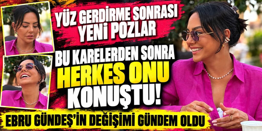 Ebru Gündeş'in Yüzündeki Değişim! 'Son Pozları' Şaşırttı!