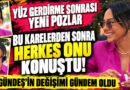 Ebru Gündeş'in Yüzündeki Değişim! 'Son Pozları' Şaşırttı!