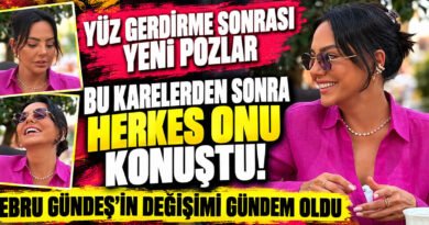 Ebru Gündeş'in Yüzündeki Değişim! 'Son Pozları' Şaşırttı!